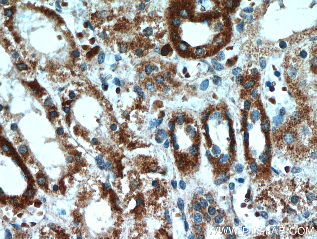 21013-1-AP;H-kidney