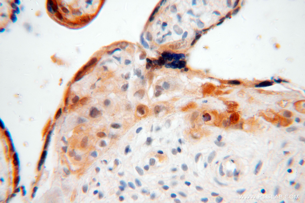 15971-1-AP;H-placenta