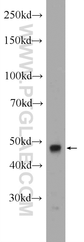 14746-1-AP;mouse testis tissue