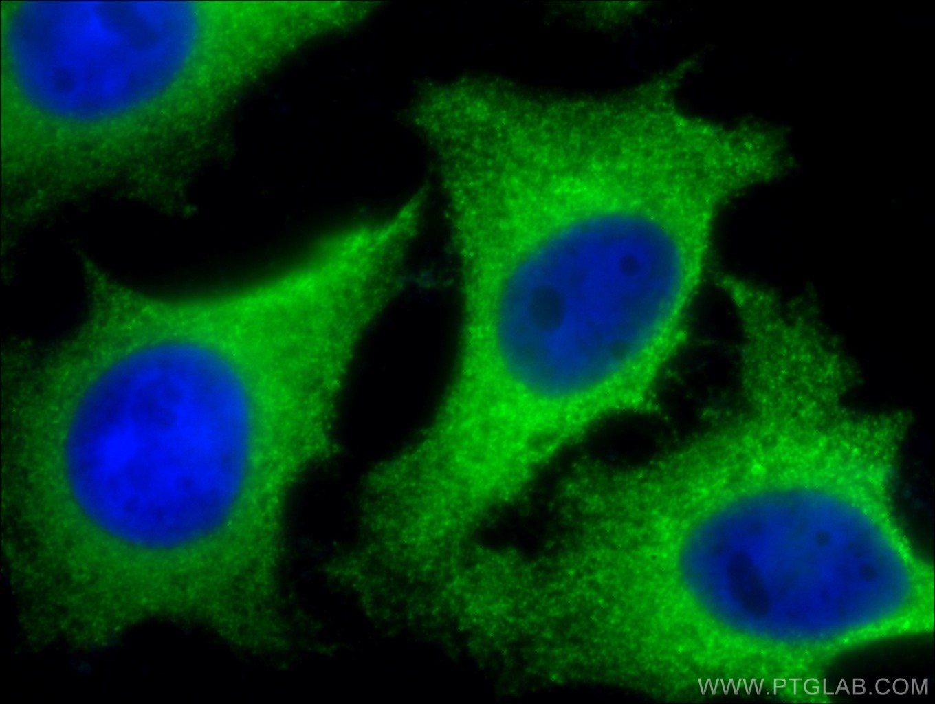 10455-1-AP;HeLa cells