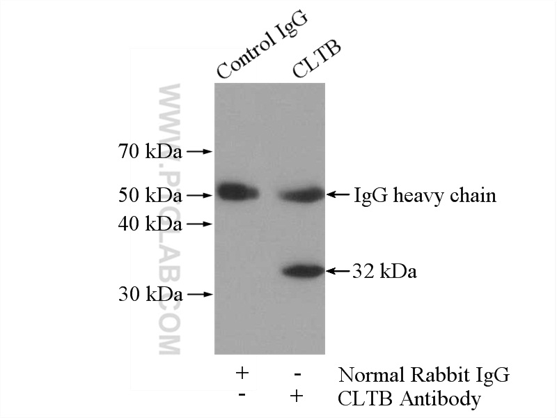 10455-1-AP;mouse brain tissue