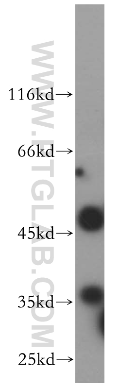17314-1-AP;HeLa cells