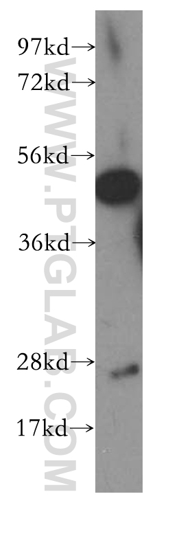 10796-1-AP;human brain tissue