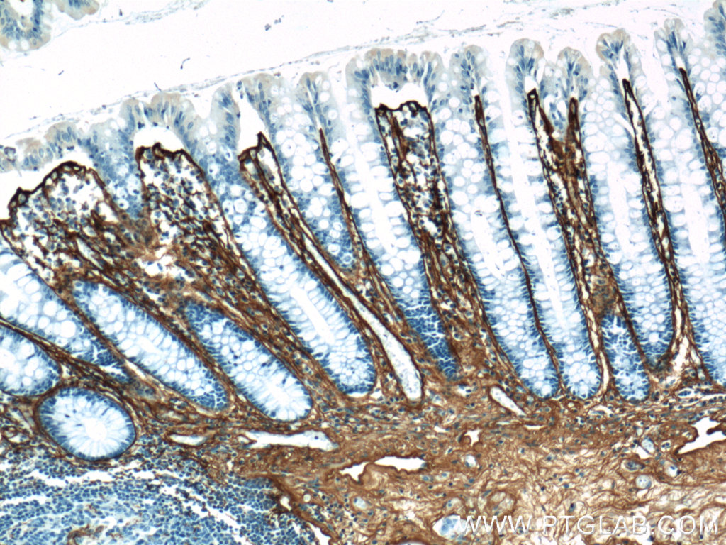 22734-1-AP;human colon tissue