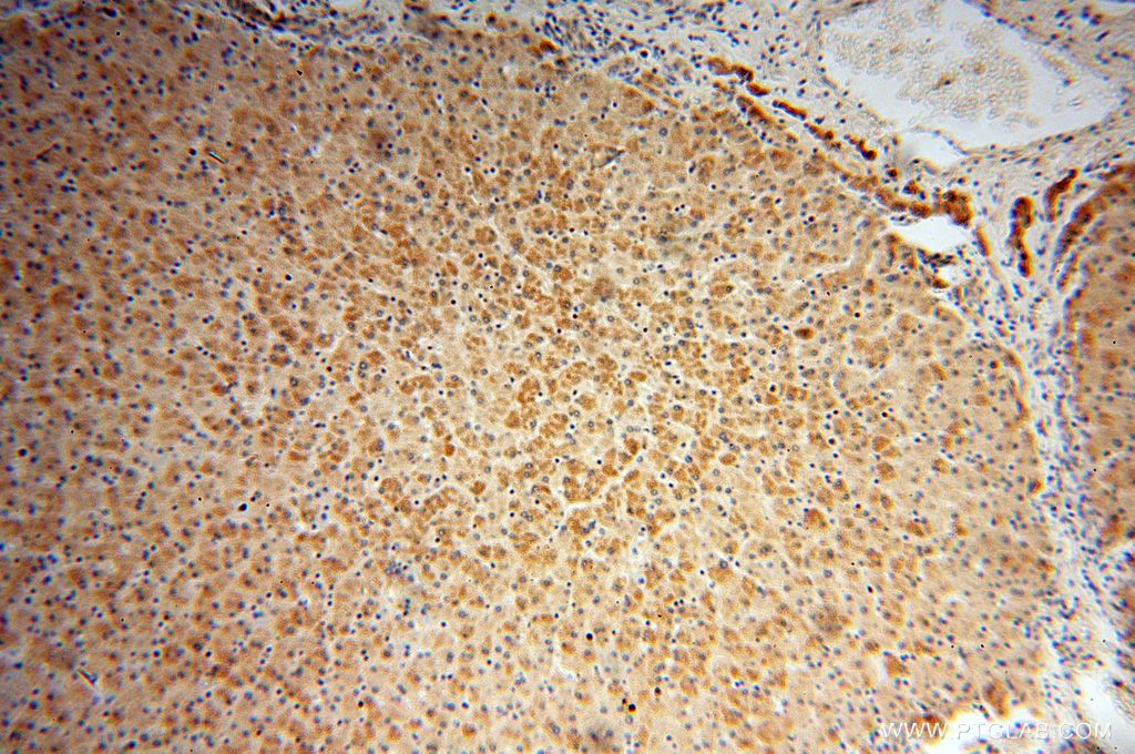 17812-1-AP;H-liver
