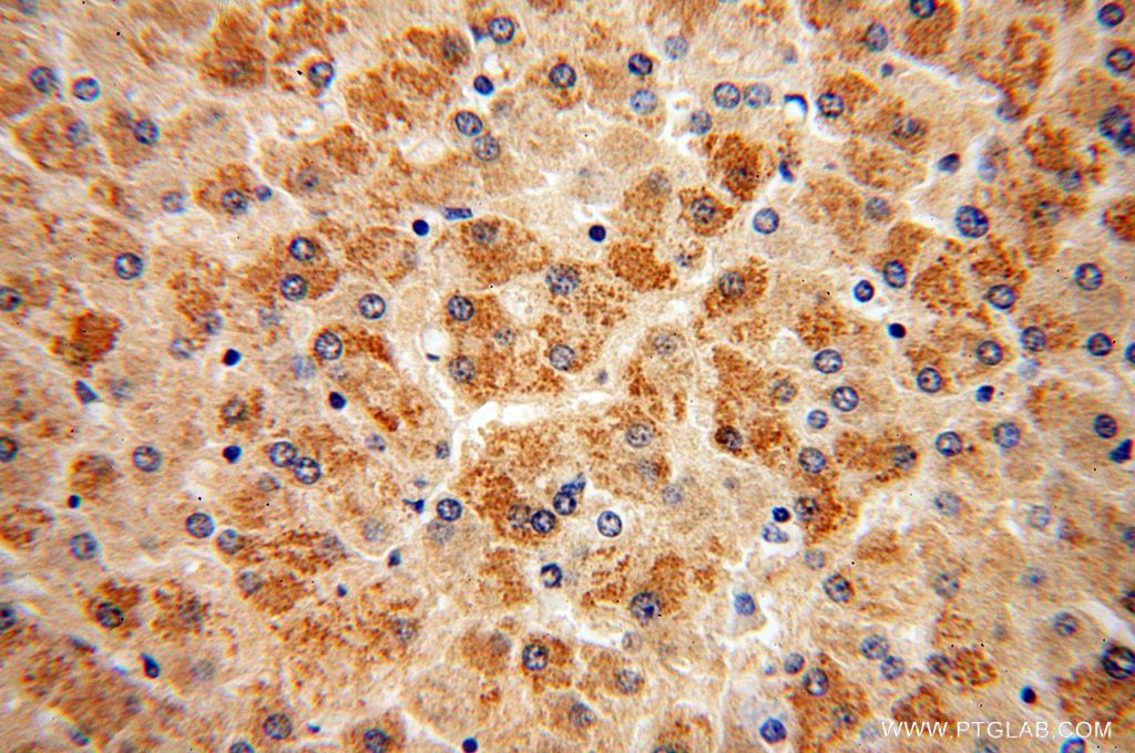 17812-1-AP;H-liver