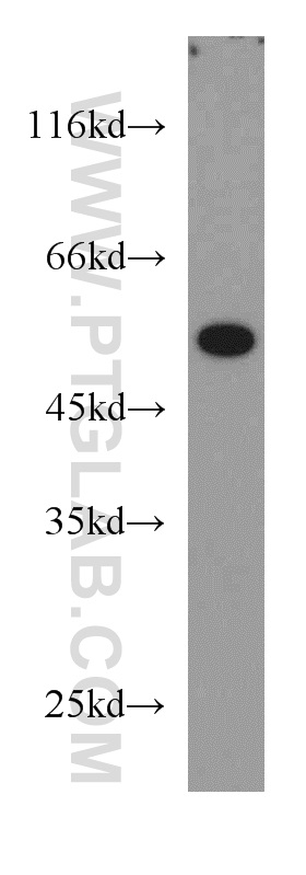 11441-1-AP;mouse skeletal muscle tissue
