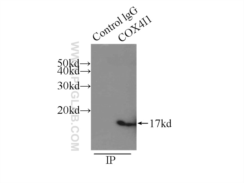 11242-1-AP;mouse skeletal muscle tissue