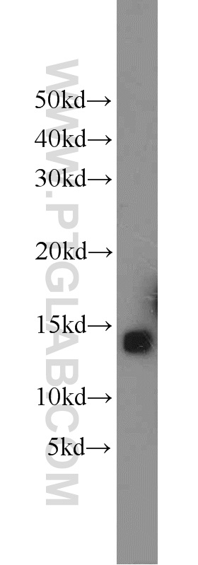 11418-2-AP;mouse liver tissue