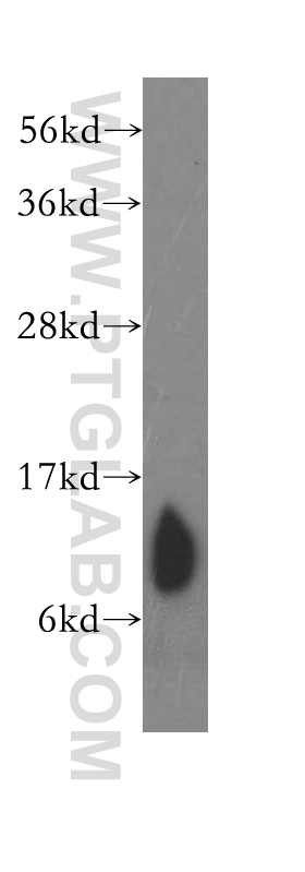 11417-2-AP;human skeletal muscle tissue