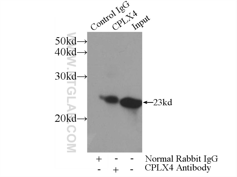 21222-1-AP;Y79 cells