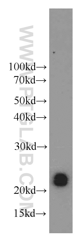 21222-1-AP;Y79 cell