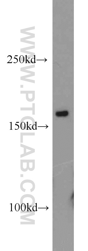 11031-1-AP;Jurkat cell
