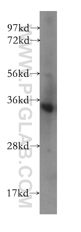 10944-1-AP;human brain tissue