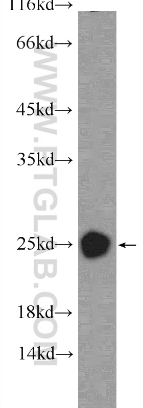 18154-1-AP;mouse brain tissue
