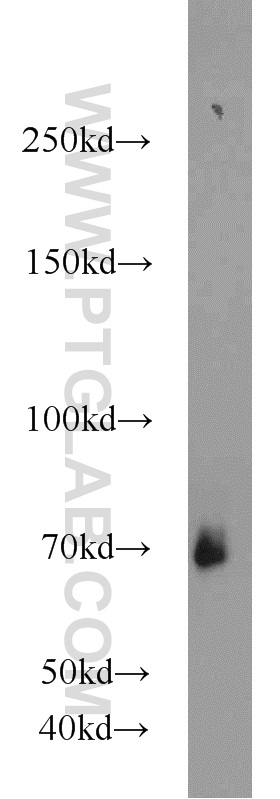 17420-1-AP;K-562 cells