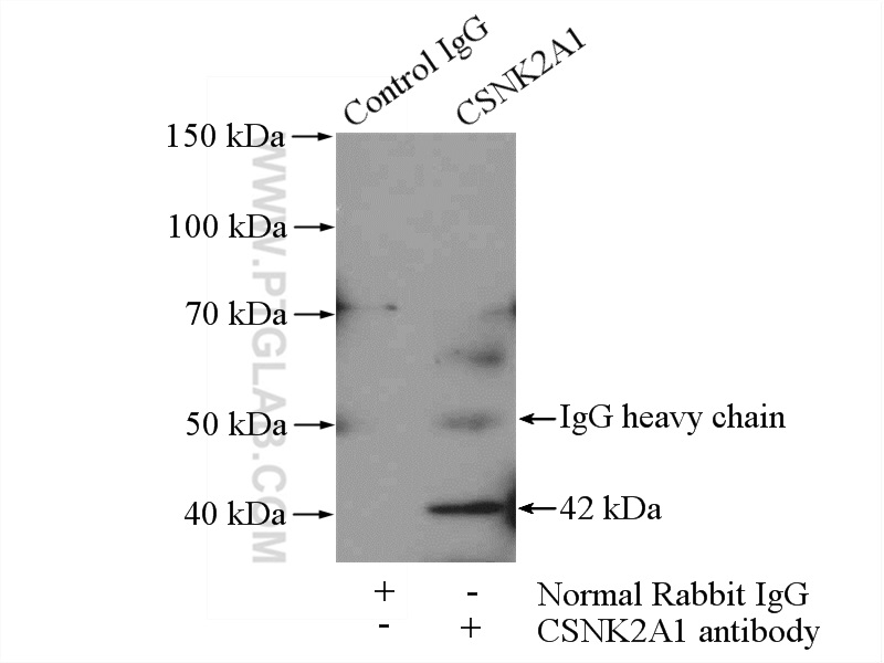 10992-1-AP;HeLa cells