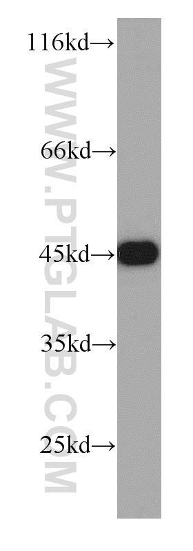 10992-1-AP;HeLa cells