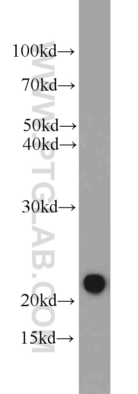 10892-2-AP;mouse liver tissue