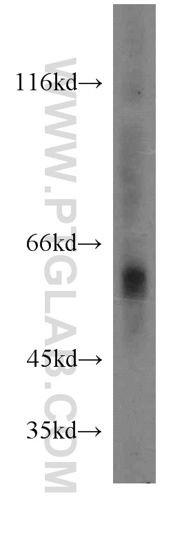 15020-1-AP;Sp2/0 cells