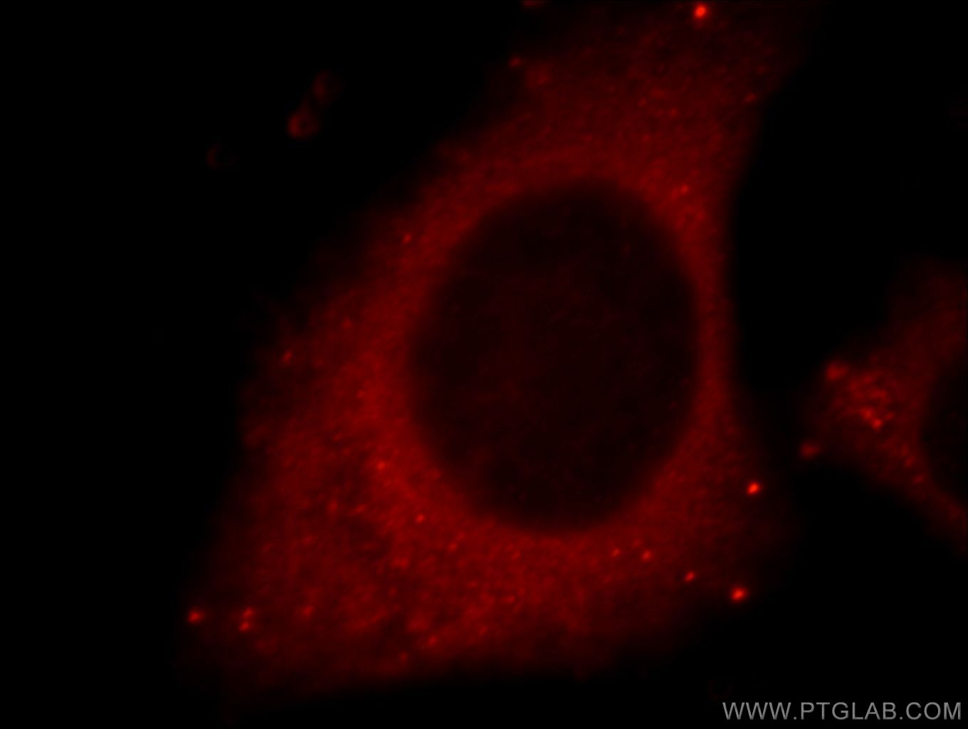 Cathepsin D Antibody 21327 1 AP Proteintech cathepsin-d-antibody-21327-1-ap-proteintech