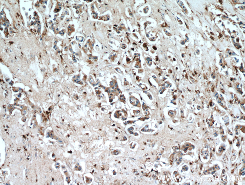 Cathepsin D Antibody 21327 1 AP Proteintech cathepsin-d-antibody-21327-1-ap-proteintech