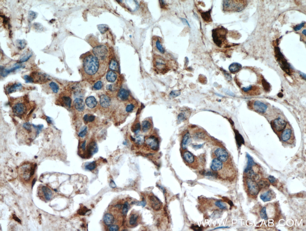 Cathepsin D Antibody 21327 1 AP Proteintech cathepsin-d-antibody-21327-1-ap-proteintech