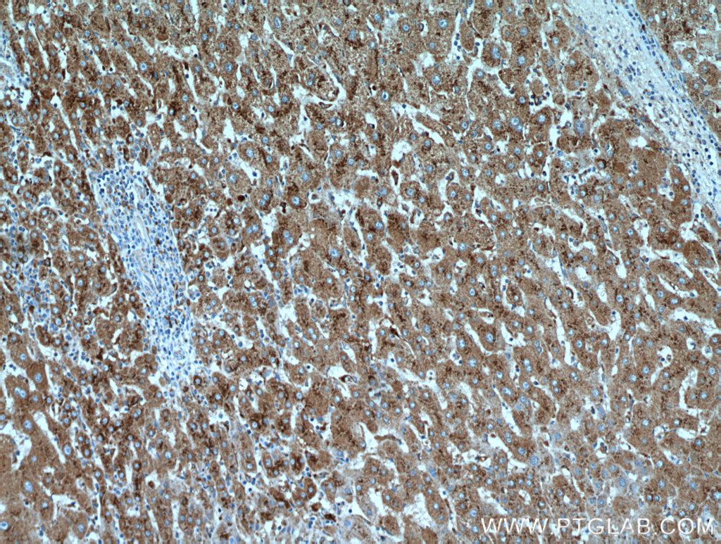 Cathepsin D Antibody 21327 1 AP Proteintech cathepsin-d-antibody-21327-1-ap-proteintech