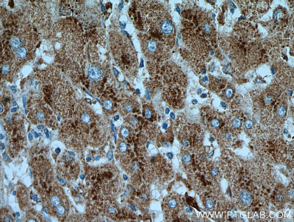 Cathepsin D Antibody 21327 1 AP Proteintech cathepsin-d-antibody-21327-1-ap-proteintech