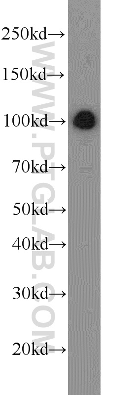 12916-1-AP;HEK-293 cells