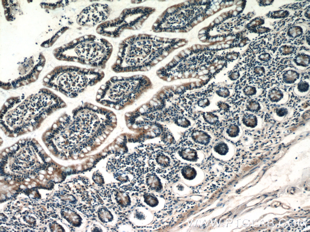 10108-2-AP;human small intestine tissue