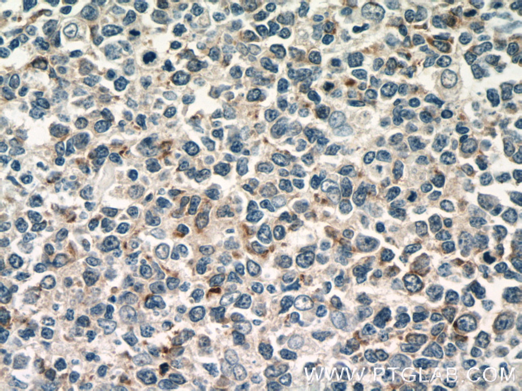 10927-1-AP;human tonsillitis tissue