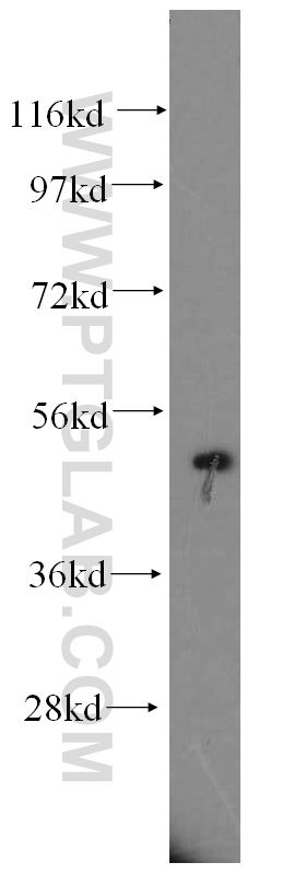 CYP17A1 Antibody 144471AP Proteintech