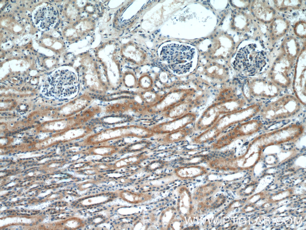 17868-1-AP;human kidney
