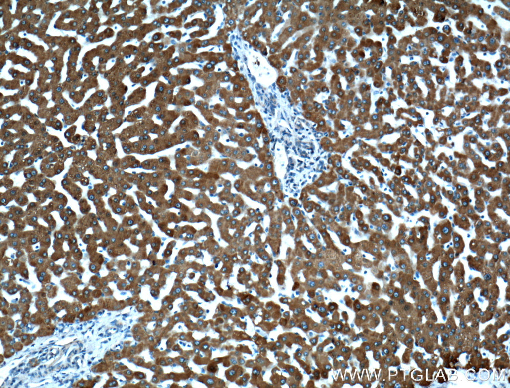 CYP3A4 Antibody 182271AP Proteintech