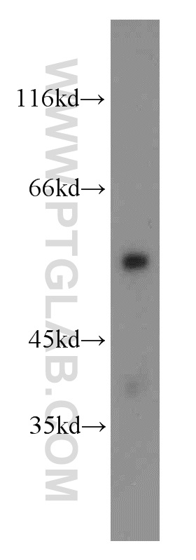 11771-1-AP;mouse lung tissue