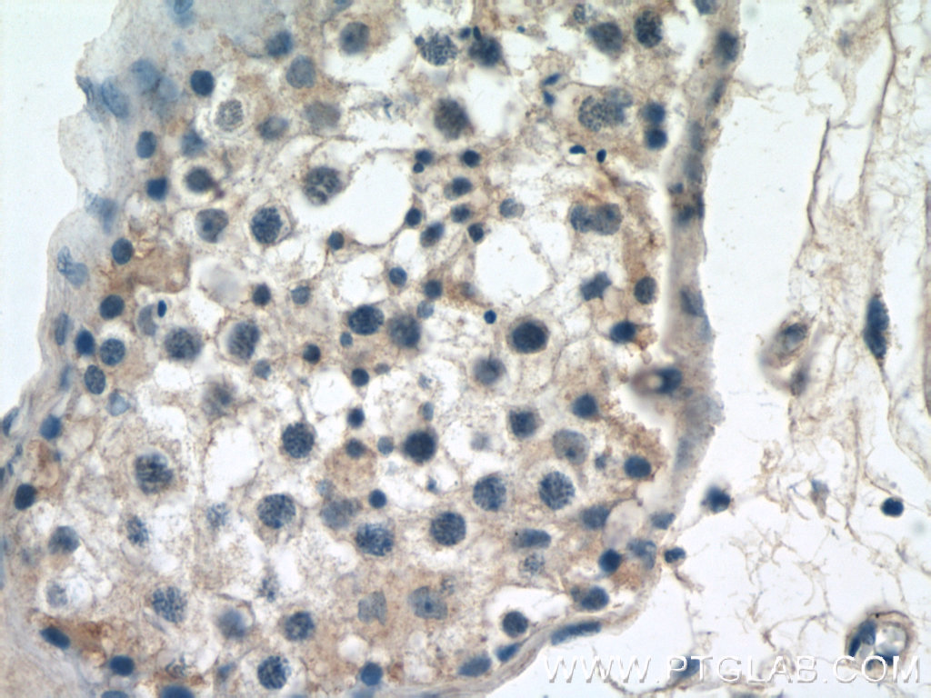25390-1-AP;human testis tissue