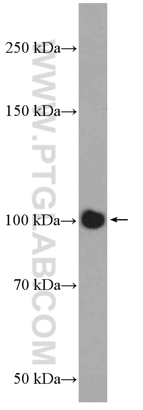 25206-1-AP;mouse brain tissue
