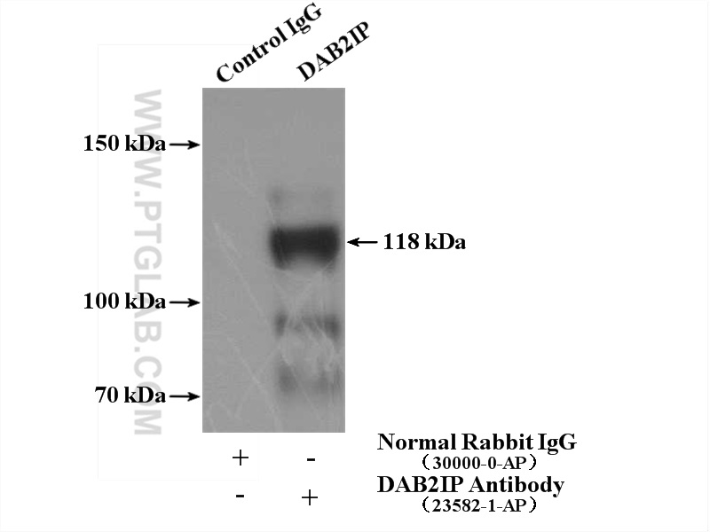 23582-1-AP;mouse brain tissue