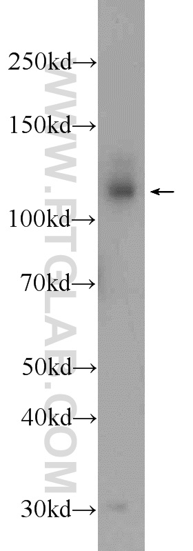 23582-1-AP;mouse brain tissue