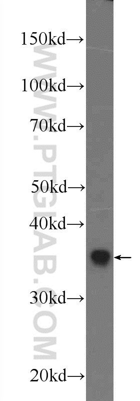 21445-1-AP;mouse liver tissue