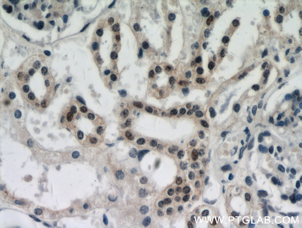 19910-1-AP;human kidney tissue