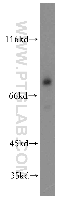 19910-1-AP;mouse brain tissue