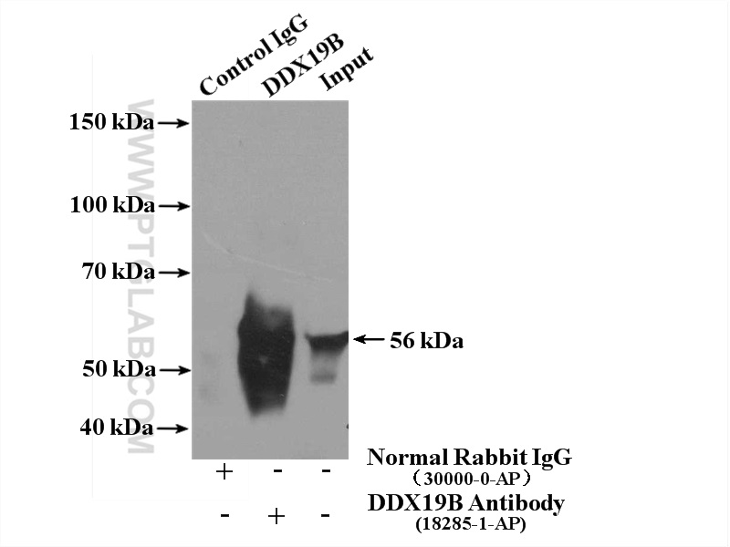 http://www.ptgcn.com/Products/Pictures/DDX19B-Antibody-18285-1-AP-IP-52429.jpg