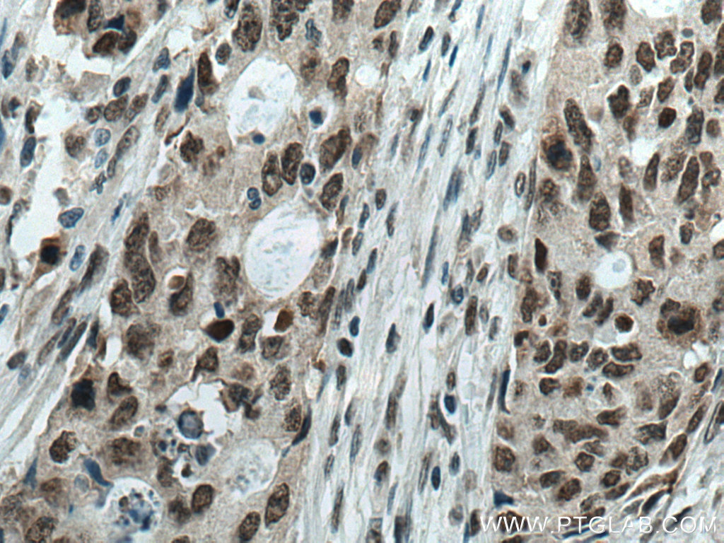 DDX21 Antibody 669251Ig Proteintech