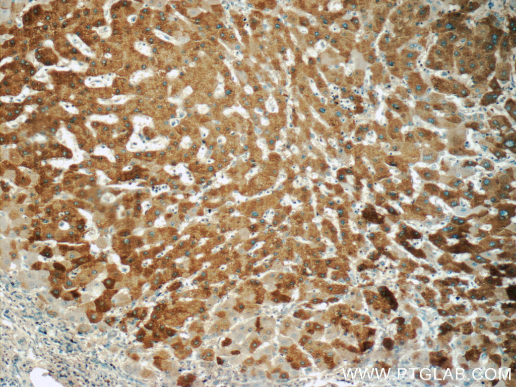 11561-1-AP;human hepatocirrhosis tissue