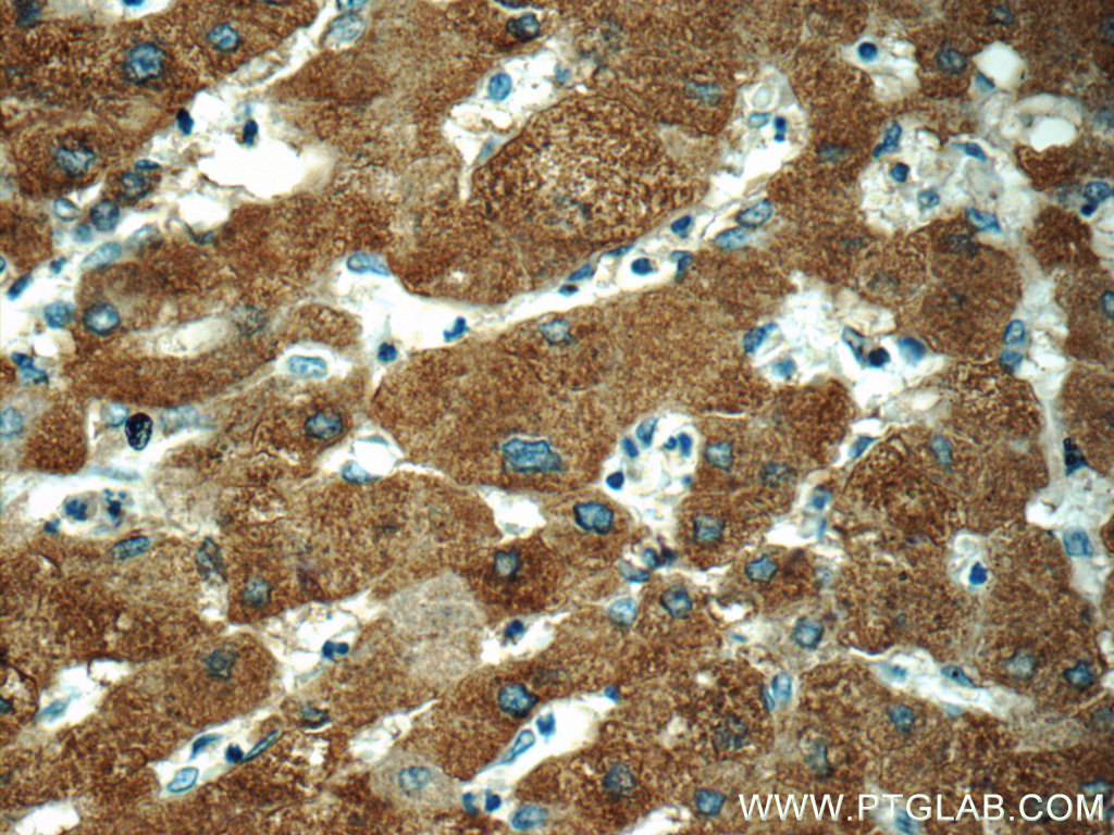 11561-1-AP;human hepatocirrhosis tissue