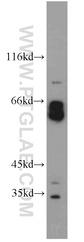 15500-1-AP;SH-SY5Y cells
