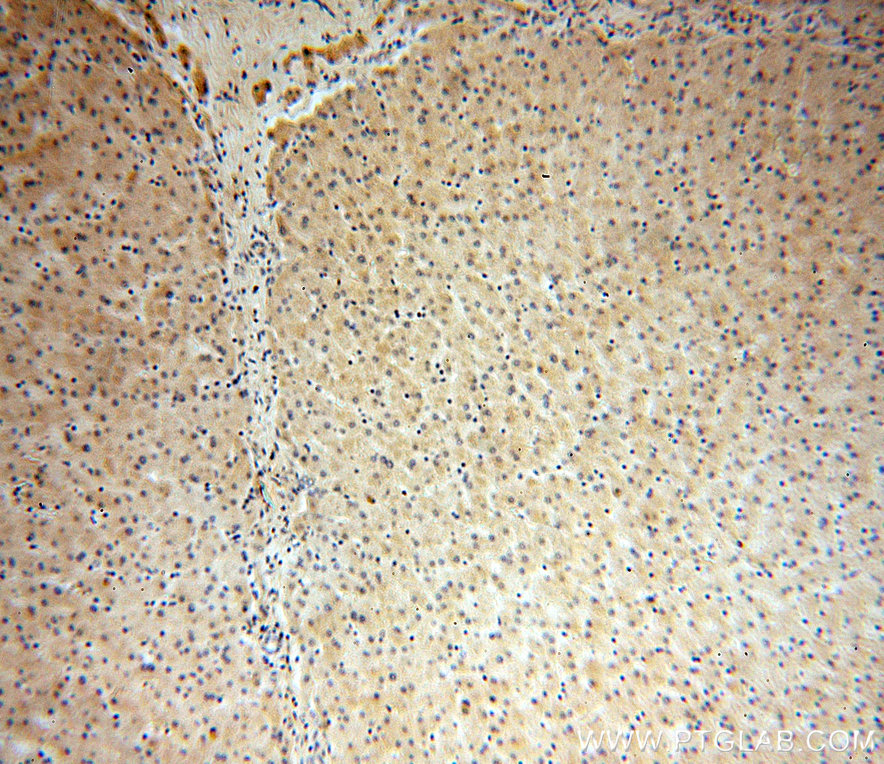 16063-1-AP;H-liver