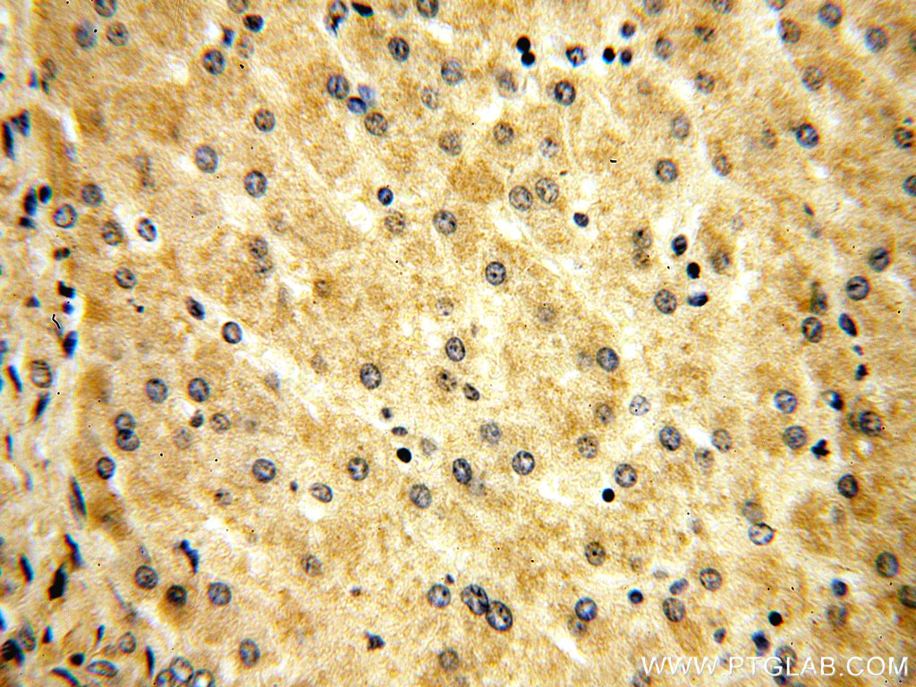 16063-1-AP;H-liver